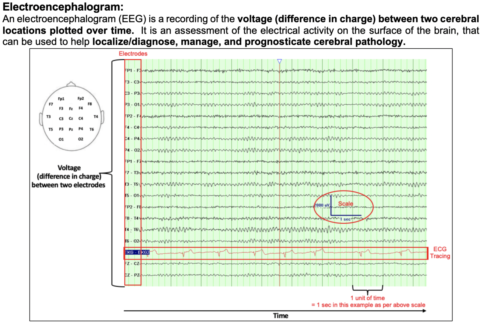 Module title = Tutorial EEG